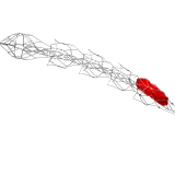 EMBOTRAP III revaskulizacijos priemonė